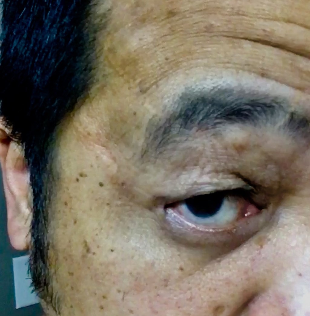 Scars from 20 Years Ago